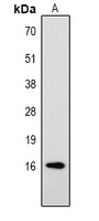 Histone H3 (Phospho-T32) antibody