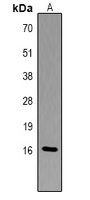 Histone H3 (Phospho-T6) antibody