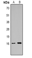 Histone H3 (TriMethyl K14) antibody