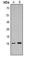 Anti-Histone H3 (TriMethyl-K14) Antibody