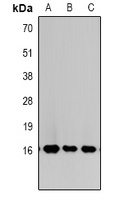 Histone H3 (TriMethyl K27) antibody