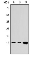 Histone H3 (TriMethyl K4) antibody
