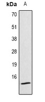 Anti-Histone H4 (Acetyl-K12) Antibody