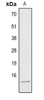 Histone H4 (AcK8) antibody