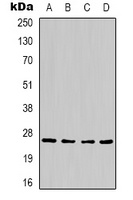 Anti-HSP27 Antibody