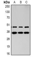 Anti-MAS Antibody