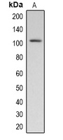 Pepsinogen C antibody