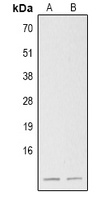 S100B antibody