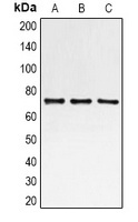Anti-S6K1 Antibody