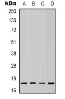 Anti-SOD1 Antibody