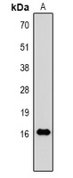 TNF alpha antibody