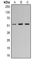 Anti-Vimentin Antibody