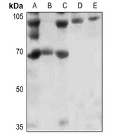 Anti-FOXO1 (Phospho-S256) Antibody