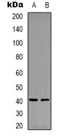 Anti-Factor XII HC Antibody