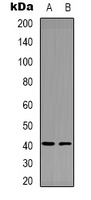 Factor XII HC antibody