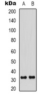 Cyclin D3 (phospho-T283) antibody