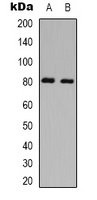 PKC theta (phospho-S695) antibody