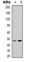 Anti-Lupus La (Phospho-S366) Antibody