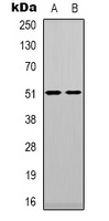 Anti-TPH1 Antibody