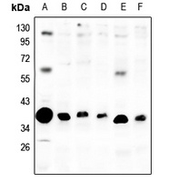 mPR alpha antibody