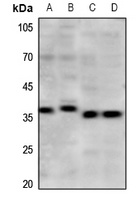 Anti-mPR gamma Antibody