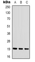 STMN1 (phospho-S16) antibody