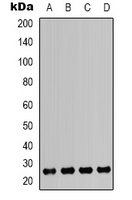 Anti-HMGB1 Antibody