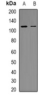 RB1 (phospho-S807) antibody