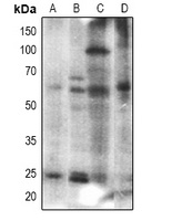 Histone Deacetylase 2 antibody