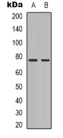Anti-BTK Antibody
