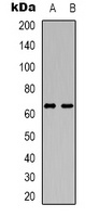 Anti-DCP1A Antibody