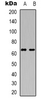 DCP1A antibody