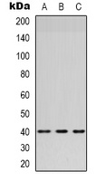 Anti-HSD3B7 Antibody
