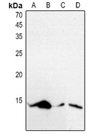 Histone H4 (AcK5) antibody
