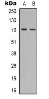 ZAP70 (phospho-Y319) antibody