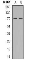 Anti-ZAP70 (Phospho-Y319) Antibody