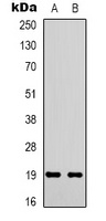 STMN1 (phospho-S38) antibody