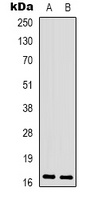 CPI17 (phospho-T38) antibody