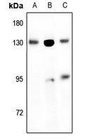 EPHB1/2 antibody