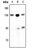 Anti-EPHB1/2 Antibody