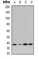 Anti-IKB alpha (Phospho-Y42) Antibody