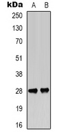Anti-BCL2 (Phospho-T56) Antibody