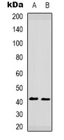 Anti-CCR5 (Phospho-S349) Antibody