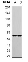 Anti-IRF3 (Phospho-S385) Antibody