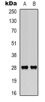 Anti-BCL2 (Phospho-S70) Antibody
