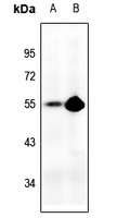 p53 antibody