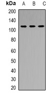 RB1 antibody