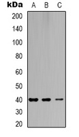 Anti-CAR Antibody