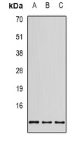 Anti-RPS20 Antibody