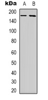 Anti-NBEAL1 Antibody
